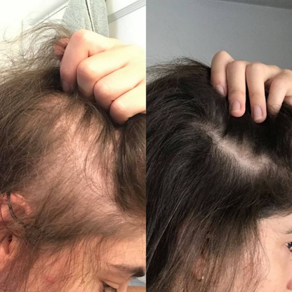 Flex Vibe - Hair Growth Spray