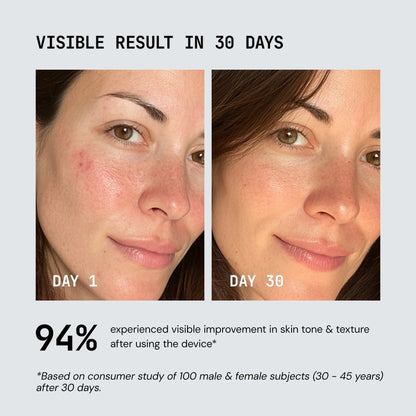 Flex Vibe Red Light Therapy Device